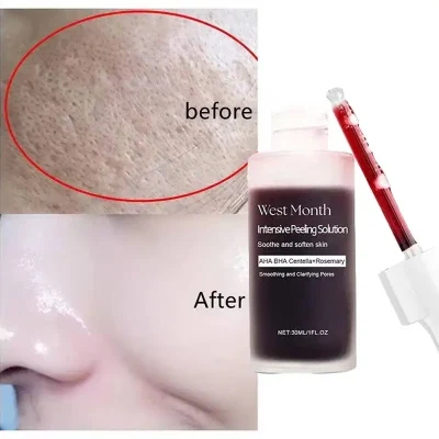 Salicylic Acid